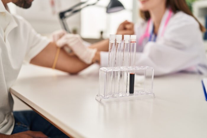 Hepatitis B Profile