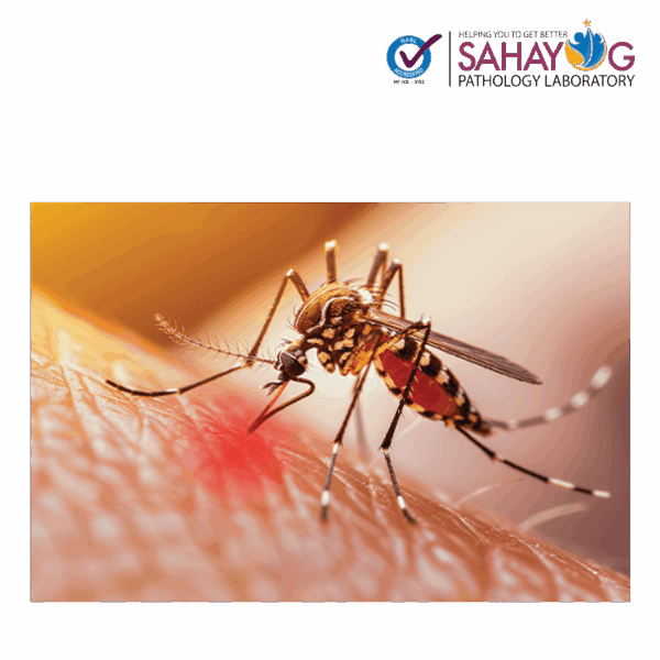 Dengue profile